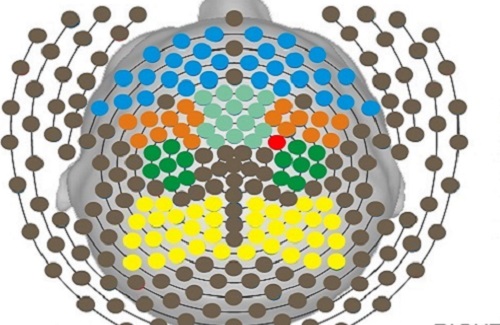 A map of the EEG channels receiving signals from the scalp. The blue dots represent the pre-frontal channels; orange dots represent the pre-motor channels; light green dots represent the supplementary motor area; dark green dots represent the primary motor; and yellow dots represent the parietal area. The single bright orange dot is channel 197 and reflects activity roughly around the pre-motor area.