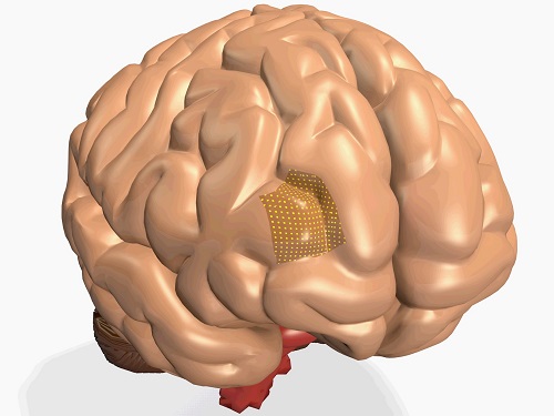 Through Polymer Vias based 3D integration simplifies the path towards high-resolution brain machine interfaces