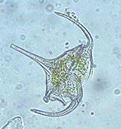 Phytoplankton under microscopy: the microbial community underpins  marine food webs, chemical cycling and carbon fixation.