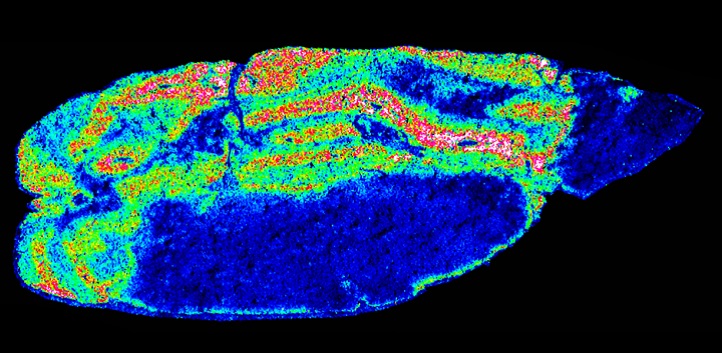 Sagittal rat brain section: Exemplary ion image of a selected mass channel acquired by MALDI imaging of a sagittal rat brain section in negative mode. This heat map represents the relative concentration of a single ion investigated in the tissue (red>yellow>green>blue).