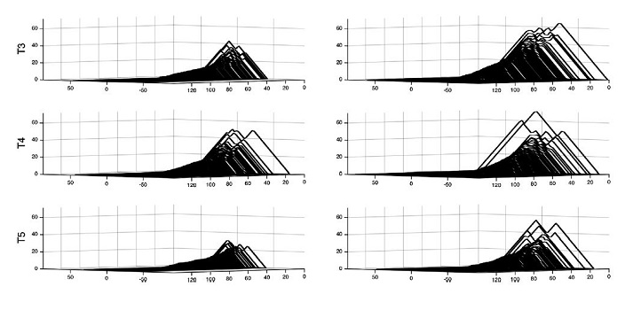 The landscape  before and during seizure EEG signals once the noise has been removed.