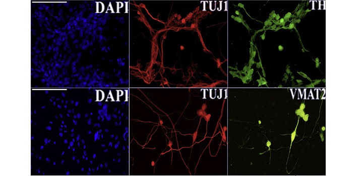 Reprogramming efficiency and cell conversion were confirmed by an immunofluorescent assay for principal neural commitment (TH, TUJ1 and VMAT2) and dopaminergic neuron markers (TH).