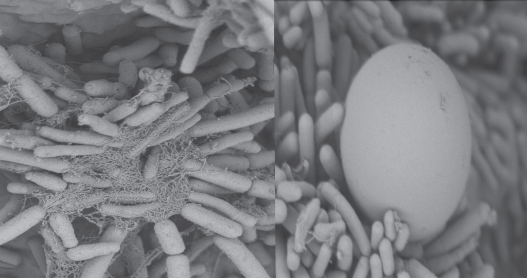 The findings suggest that minor gut microbes may play an important role when bees are under stress due to unusual environmental conditions, such as climatic change.