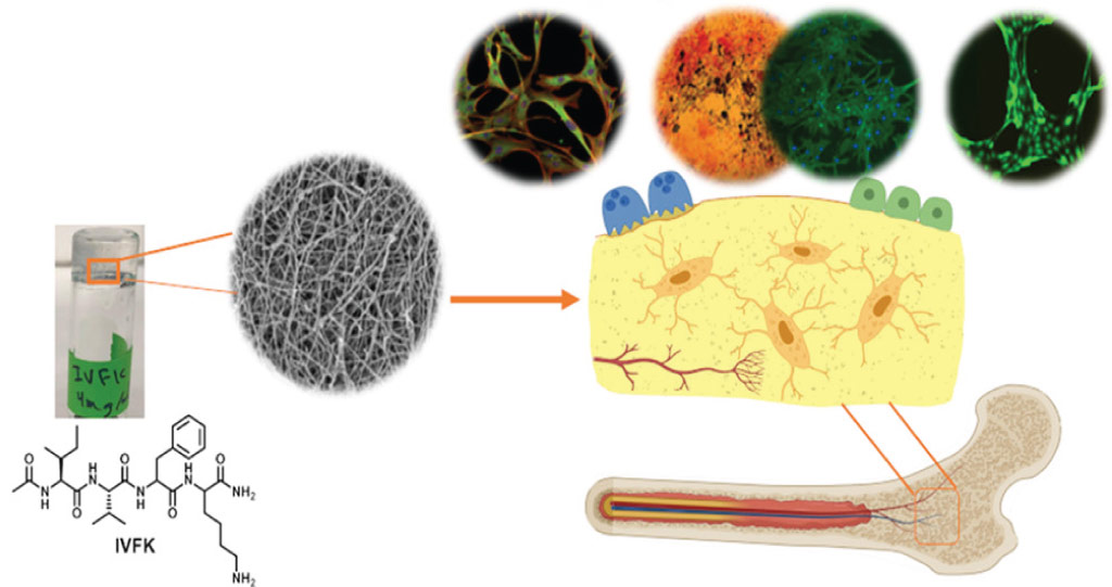 The team seeded their peptide scaffolds with bone marrow–derived mesenchymal stem cells and found that the cells, under appropriate conditions, could convert into bone-forming osteocyte cells.