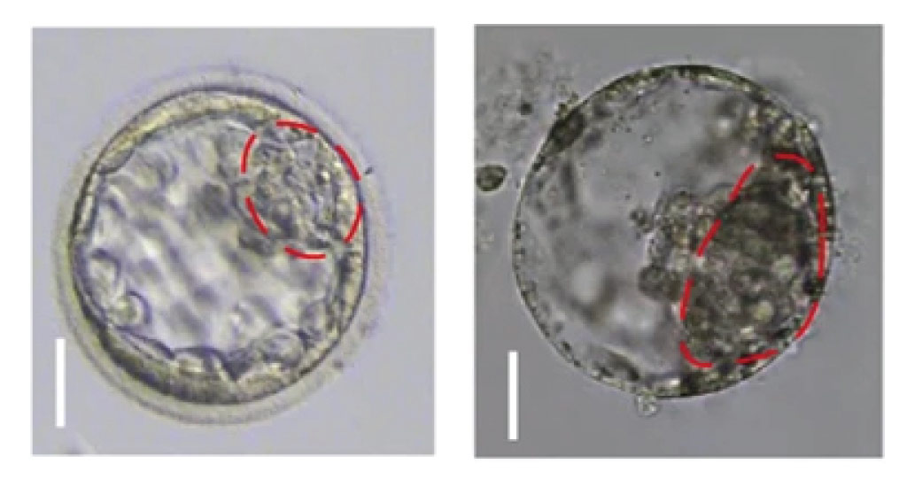 A natural human embryo (left) and a human blastoid made from stem cells (right).