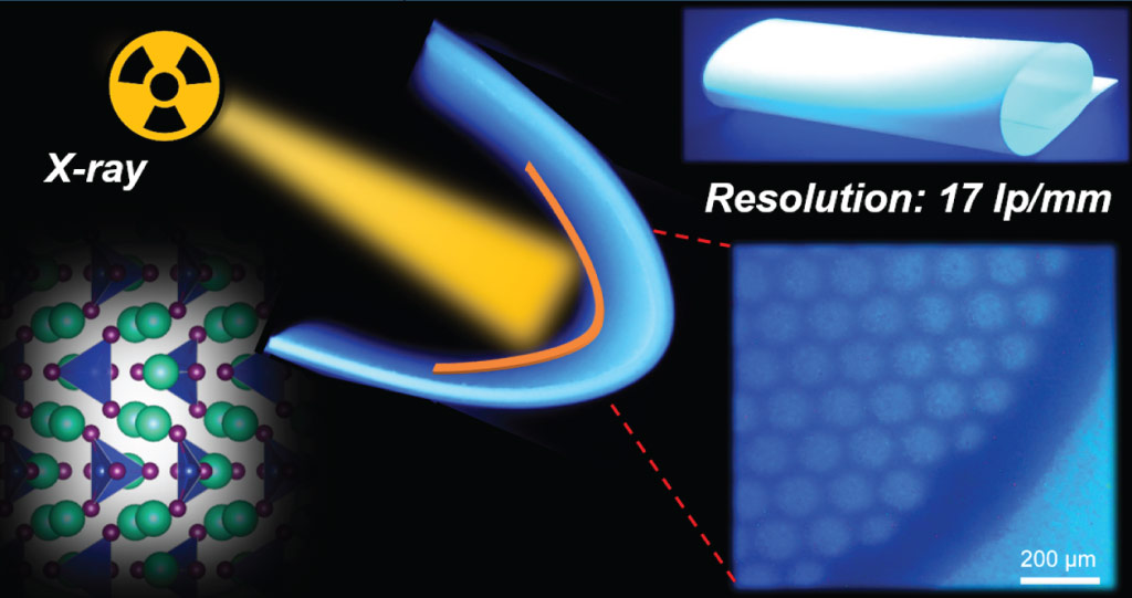 The flexible scintillation screens developed by the team can detect X-rays at ultralow levels, approximately 113 times lower than a typical standard dose for X-ray medical imaging.