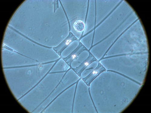 A colony of oceanic diatoms similar to those found at a depth of 4,000 meters during the Malaspina 2010 Circumnavigation Expedition.