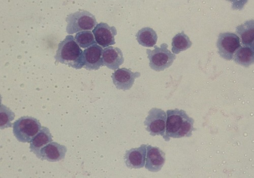 Antibodies that block CD44 could help destroy acute myeloid leukemia cells.