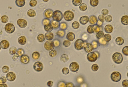 Symbiodinium cells viewed through a light microscope.