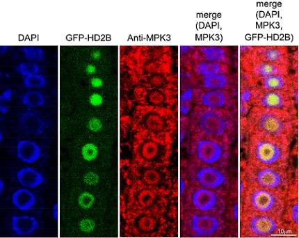 Immunofluorescence assays show the location of key components in the pathway to plant immunity: left, blue indicates cell nuclei; second left, HD2B within the nucleolus; center, MPK3 distributed both inside and outside the nuclei; second right and right, superimpositions of these images clearly show the differential location of HD2B and MPK3 within plant cells.