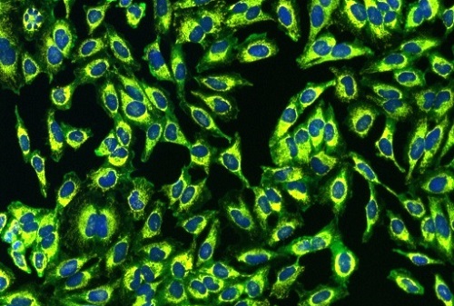 The effect of plant fractions of HeLa cells.  Pictured are nuclei, mitochondria, cytochrome C and NF-κB that have been stained by fluorescent probes.