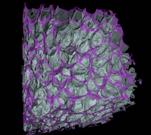 A 3D reconstruction of SEM images at the macroscale by serial block face shows the spherical compartments that are a tiny 5μm in diameter.