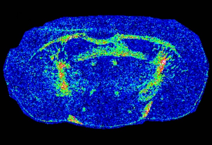 Coronal rat brain section: Exemplary ion image of a selected mass channel acquired by MALDI  imaging of a coronal rat brain section in negative mode. This heat map represents the relative concentration of a single ion investigated in the tissue (red>yellow>green>blue).