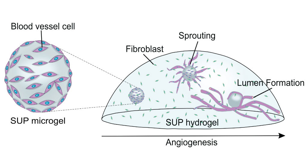 Delivering blood-vessel cells into the self-assembling ultrashort peptide microgel triggers angiogenesis.